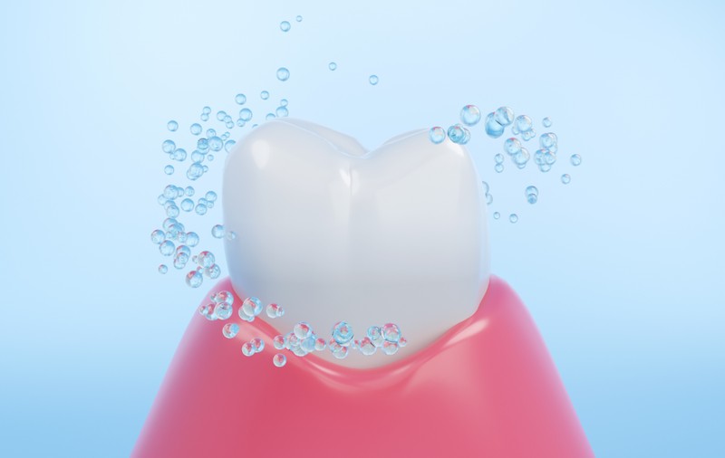 Sănătate dentară de la A la Z: implant dentar și tratamente de ortodonție