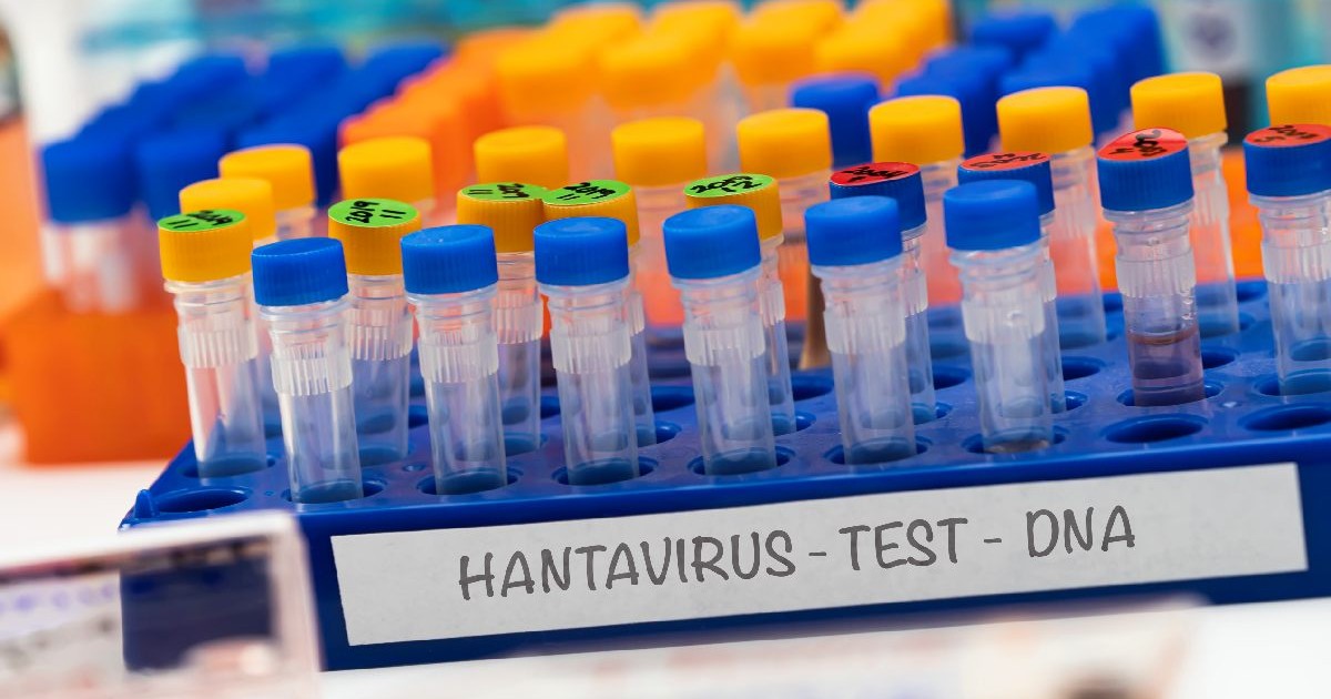 Mai multe eprubete cu teste de Hantavirus. Caz de Hantavirus in România