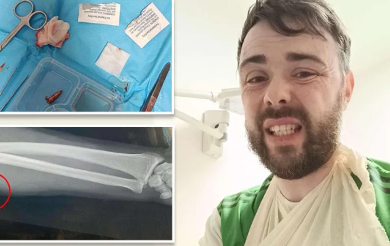 Fotbalist împușcat în braț, în timpul unui meci din Irlanda. Glonțul rătăcit a fost tras de un vânător de căprioare, în pădurea din apropierea terenului