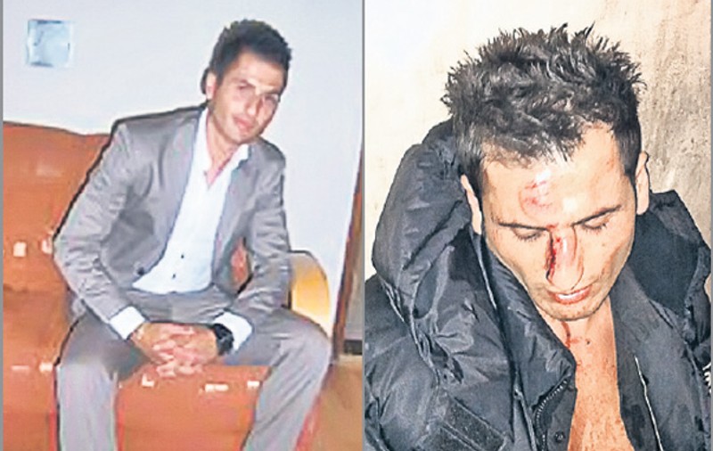 Racaj, ospătarul agresat de Mutu, «și-a reparat» nasul!