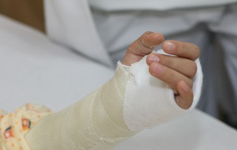 Studiu: fumatul prelungeşte cu şase săptămâni perioada de vindecare a fracturilor 