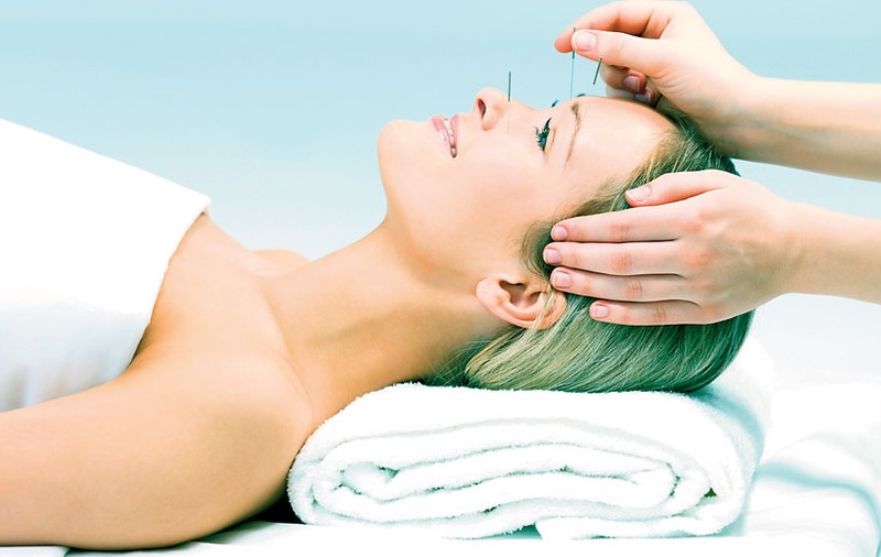 Şi prin acupunctură îţi poţi întineri chipul