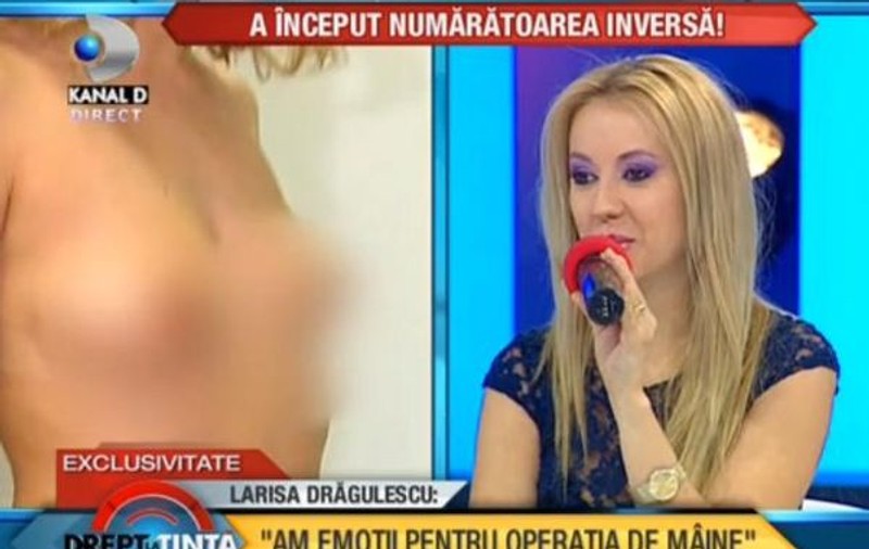 Larisa Drăgulescu îşi pune silicoane | FOTO