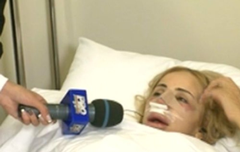 Daniela Gyorfi şi-a operat nasul şi buzele fără să ştie George Tal | FOTO