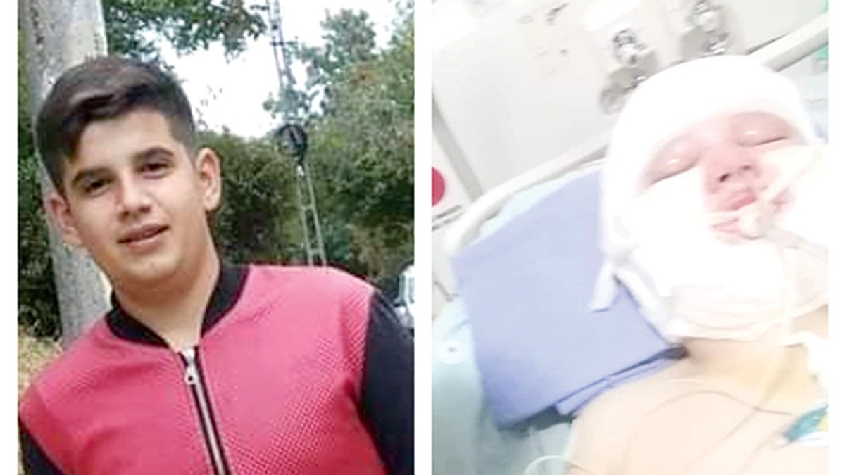 Pompierii din Huși l-au ajutat de două ori pe elevul ars în explozia de la service. L-au salvat din flăcări, apoi au donat bani pentru tratament