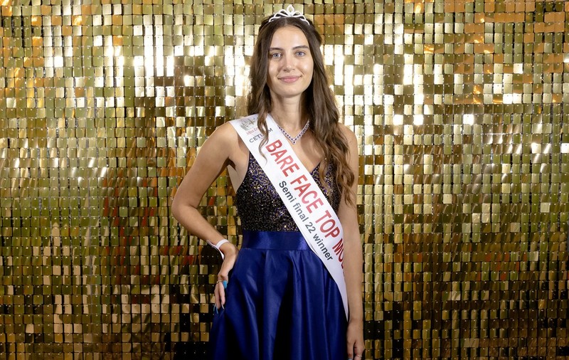 Niciodată în istoria de 100 de ani a Miss Anglia nu s-a mai întâmplat așa ceva: o tânără de 20 de ani concurează fără machiaj. „Defectele noastre ne fac să fim cine suntem” - FOTO