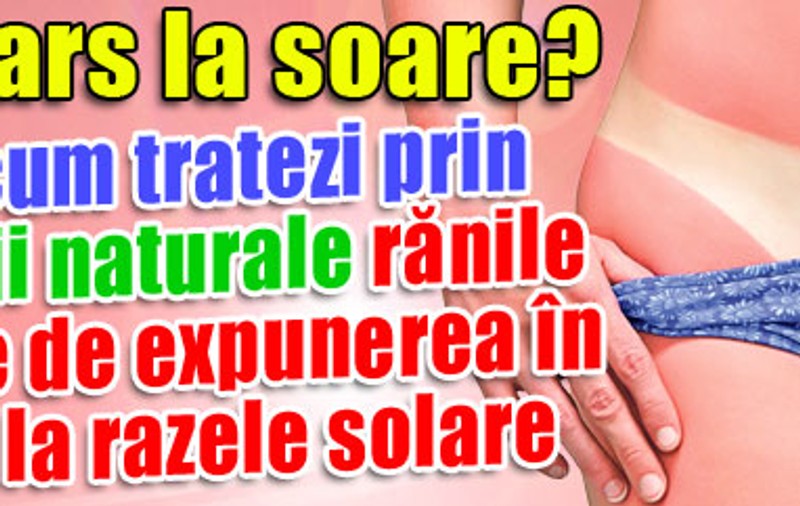 Te-ai ars la soare? Află cum tratezi prin remedii naturale rănile cauzate de expunerea în exces la razele solare