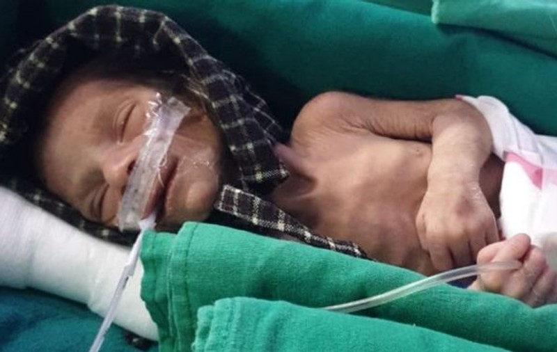 Fetiță nou-născută, găsită vie într-un mormânt improvizat în India