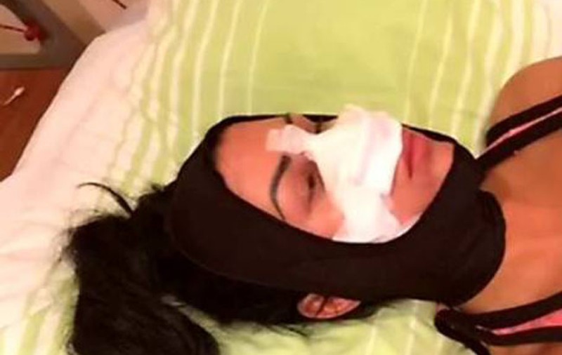 Ce se întâmplă cu Daniela Crudu la o săptămână după ce şi-a operat nasul! Când revine pe micile ecrane!