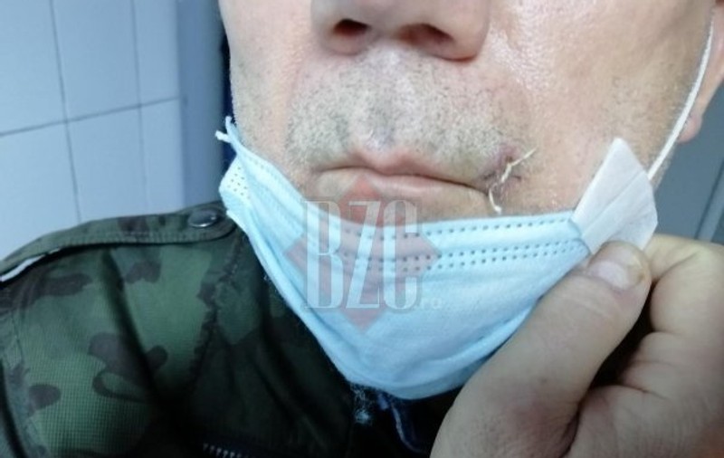 Un bărbat din Câmpia Turzii a fost înjunghiat de un vecin de bloc pe motiv că sforăie îngrozitor
