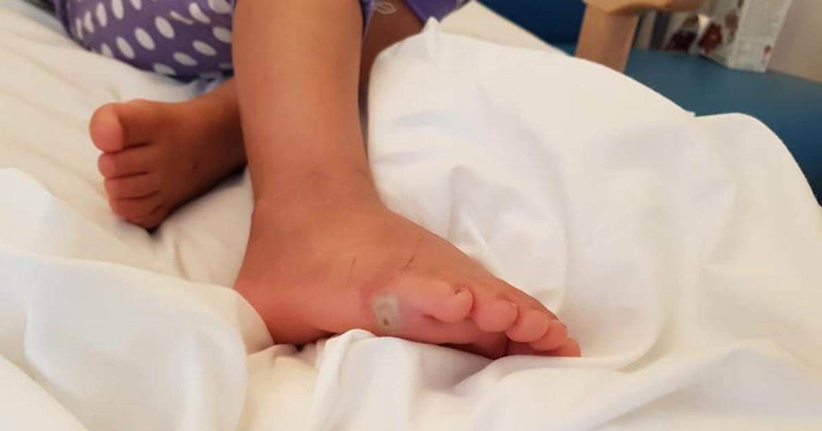 Copila a contactat o bacterie după ce a probat o pereche de pantofiori
