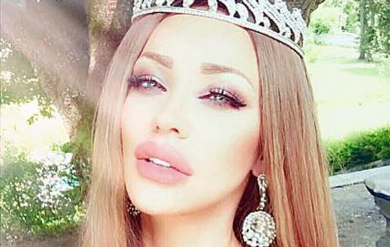 Bianca Drăgușanu, exasperată de buzele prea mari! "Nu știu cum să scap de ele"