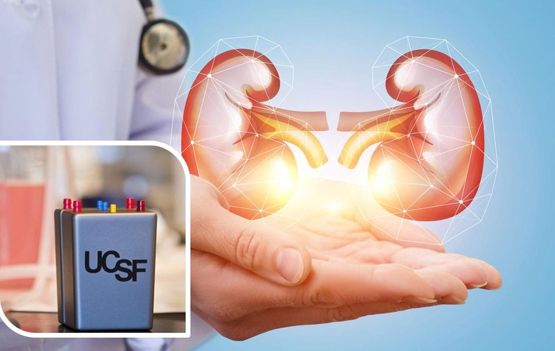 Rinichii bioartificiali - Dispozitive revoluționare.