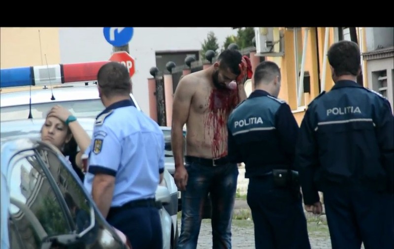 IMAGINI ȘOCANTE! Conflict sângeros într-un bar din Buzău, după meciul României