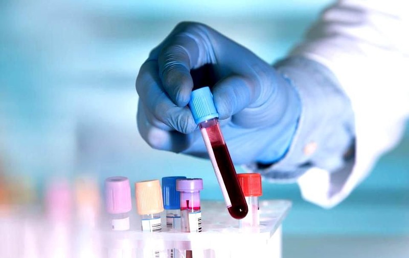 Peste 50 de tipuri de cancer pot fi detectate printr-un simplu test de sânge