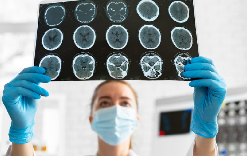 Peste 60.000 de români suferă anual traumatisme craniene grave! Accidentele rutiere fac prăpăd: costul tratamentului pentru un singur pacient poate ajunge la 4 milioane de dolari