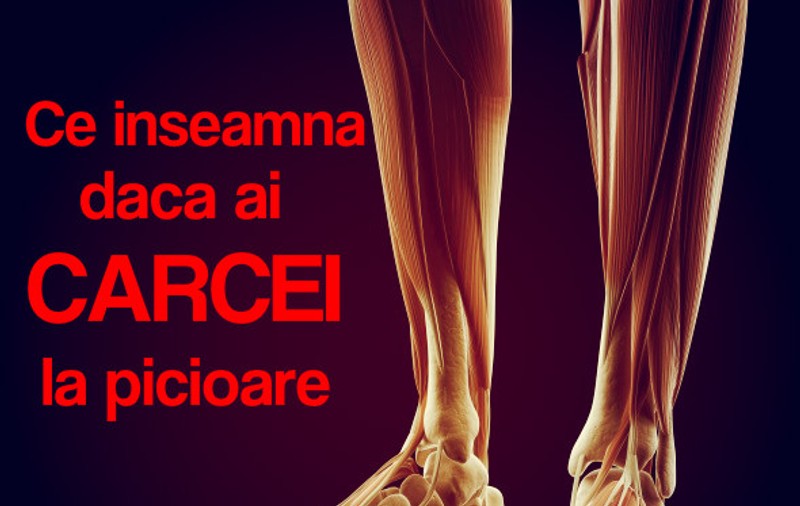 SUFERI DE CÂRCEI? VEZI MOTIVELE PENTRU CARE APAR ŞI AFLĂ CUM SĂ SCAPI DE EI