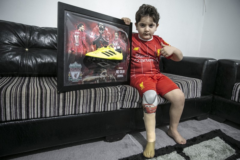 Un băiat sirian de 8 ani, care și-a pierdut piciorul în urma unui bombardament, a primit cadou o gheată de fotbal cu autograful superstarului lui Liverpool, egipteanu Mohamed Salah FOTO: Cem Genco / Anadolu Agency/ABACAPRESS.COM