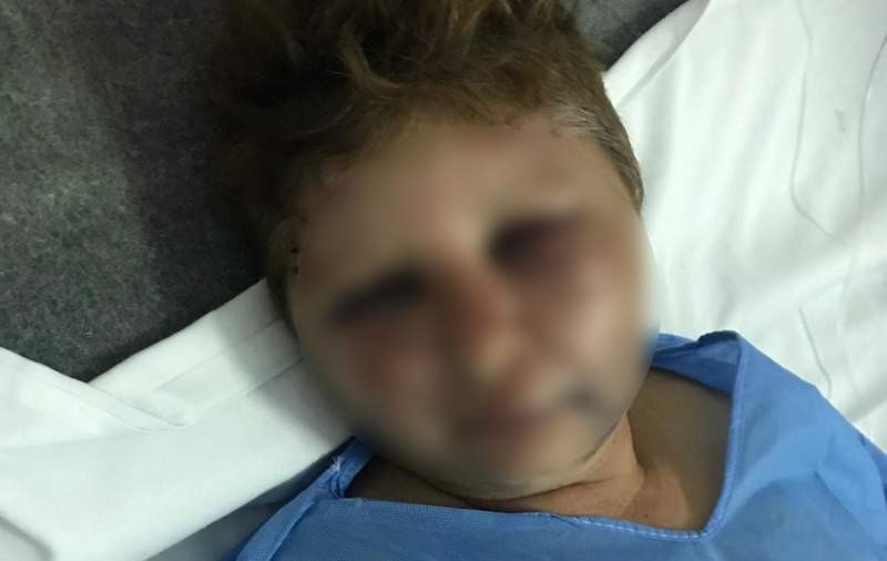 Un polițist din Olt e acuzat că a desfigurat în bătaie o femeie: „Mi-a dat cu pumnii și cu picioarele”