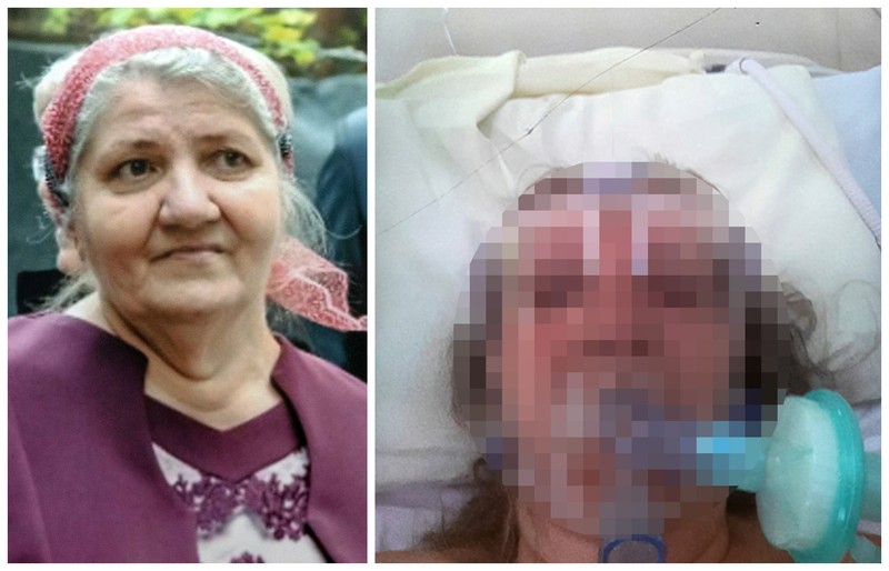 Ane Nagy, înainte și după ce a intrat în spital