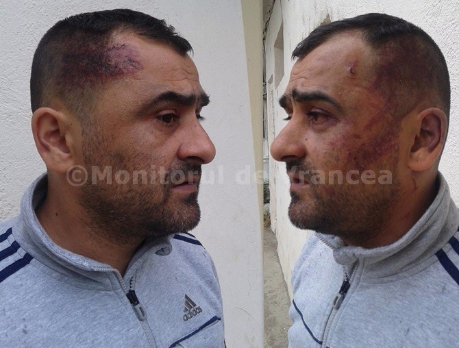 Aşa arată antrenorul Şerbănică după ce a fost bătut cu bestialitate