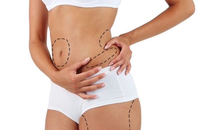 Liposculptura 3D cu Vibrasat Pro - Artă și Precizie în Conturarea Corpului