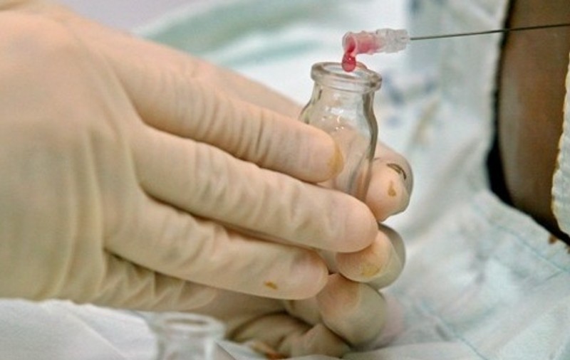 SUA aprobă prima linie de celule embrionare pentru cercetare