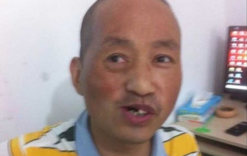 Lumea medicală, ȘOCATĂ. S-a operat singur de cancer la gură