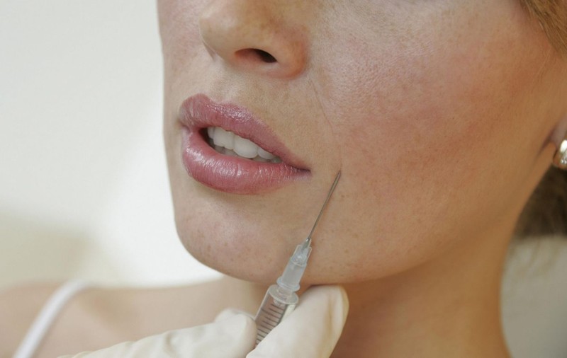 Avocată din Alba Iulia, desfigurată după o intervenție estetică! Ce i-a injectat medicul, în loc de botox? FOTO ȘOCANT
