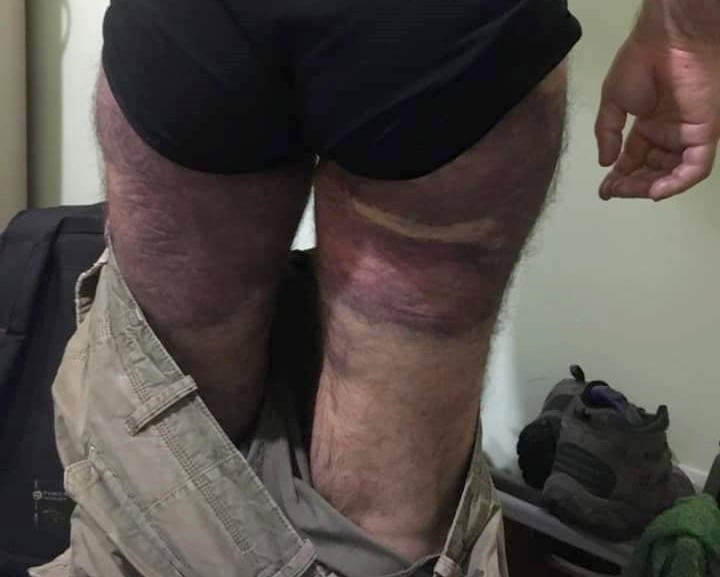 Urmele loviturilor primite de Ionuț Ghiorghe, victima polițiștilor. Sursa foto: pagina de facebook a lui Ionuț Ghiorghe