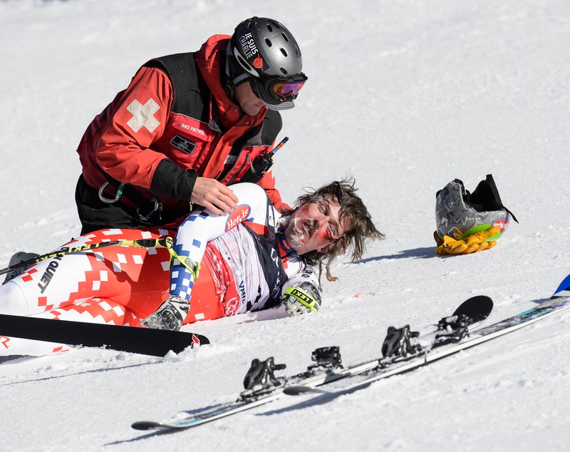 Schiorul Ondrej Bank, accidentare care l-a desfigurat / FOTO