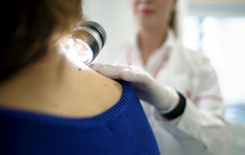 Primul centru multidisciplinar integrat pentru tratarea melanomului deschis în cadrul spitalului Euroclinic