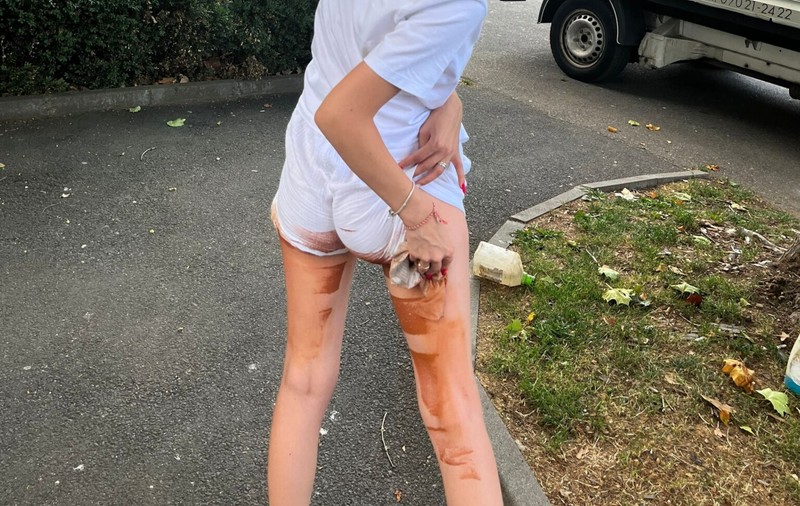 „A început să zbiere, mi-a spus să mă spăl cu benzină”: pățania tinerei care s-a așezat pe o bancă proaspăt vopsită și nesemnalizată din Sibiu