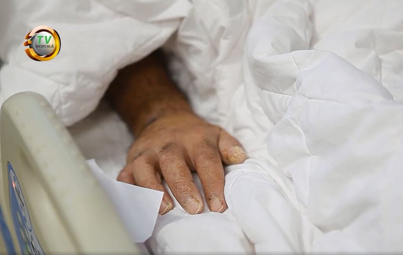 Povestea primului pacient COVID salvat cu un plămân artificial, la Timișoara: un bărbat cu 13 copii, care nu credea în existența virusului