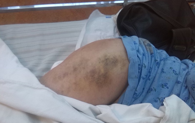Revoltător! O bătrână din Vaslui, ignorată de medici şi lăsată cu dureri crunte pe patul de spital