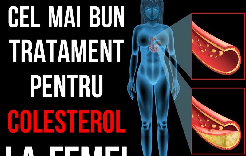 VEZI CARE E CEL MAI BUN TRATAMENT PENTRU COLESTEROL LA FEMEI!