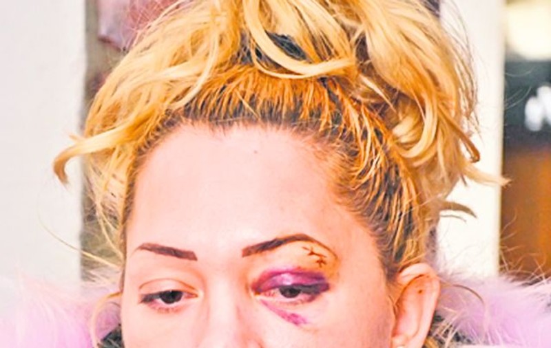 Bete-criţă, Chrissy Givens şi Monique Coker, baschetbaliste la CSM Târgovişte, au bătut crunt o femeie într-un club din Satu Mare