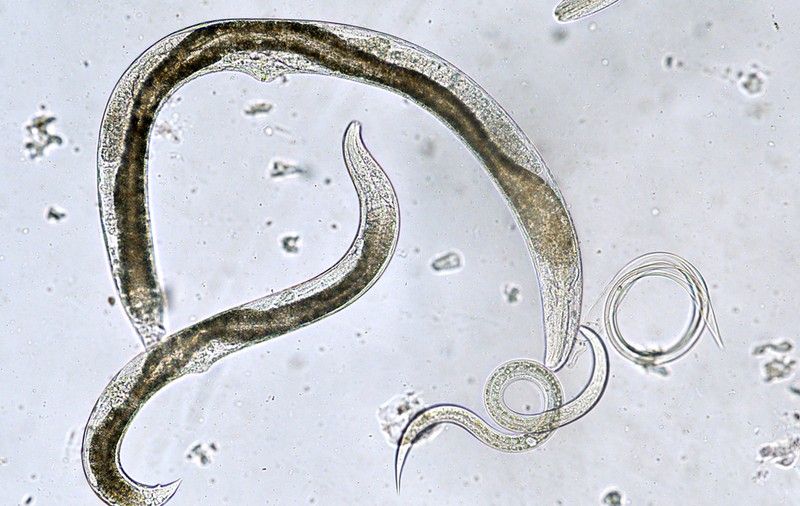 Semne că ai paraziți în organism