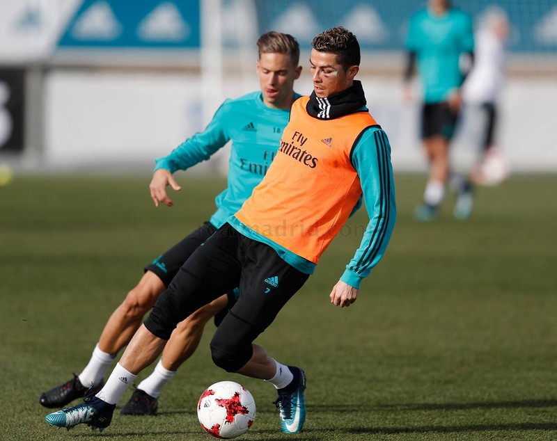 Cum arată fața lui Cristiano Ronaldo după accidentare / VIDEO