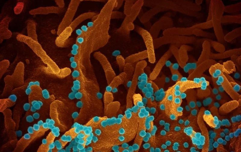 Cum au fost realizate cele mai impresionante imagini cu COVID-19. “Încercăm să-l facem vizibil, ca să vadă oamenii cu cine luptăm”