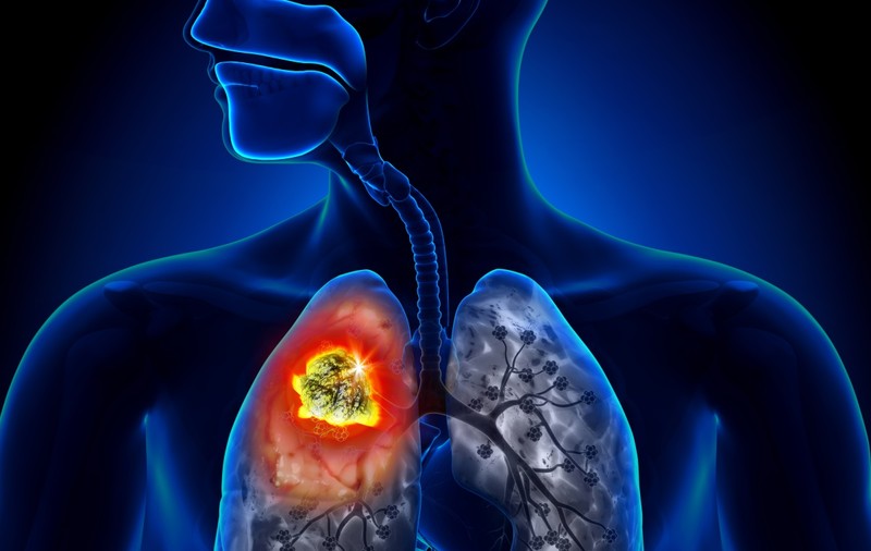 3 legume de sezon, benefice împotriva cancerului