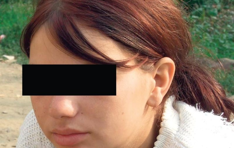Bomba SIDA» a fugit pentru a şasea oară din centrul de plasament