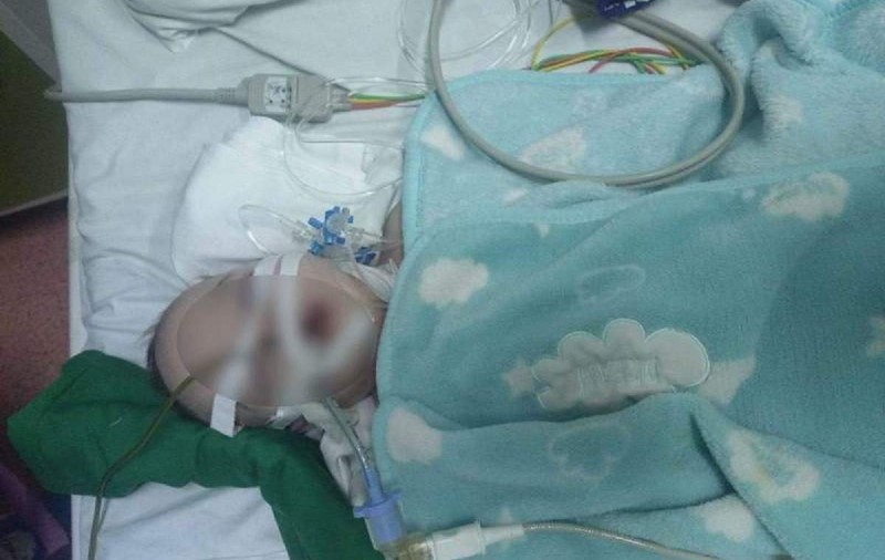 Un bebeluș internat cu bronșită a murit la Spitalul din Oradea. Părinții cred că băiețelul lor ar fi luat rujeolă de la un alt copil