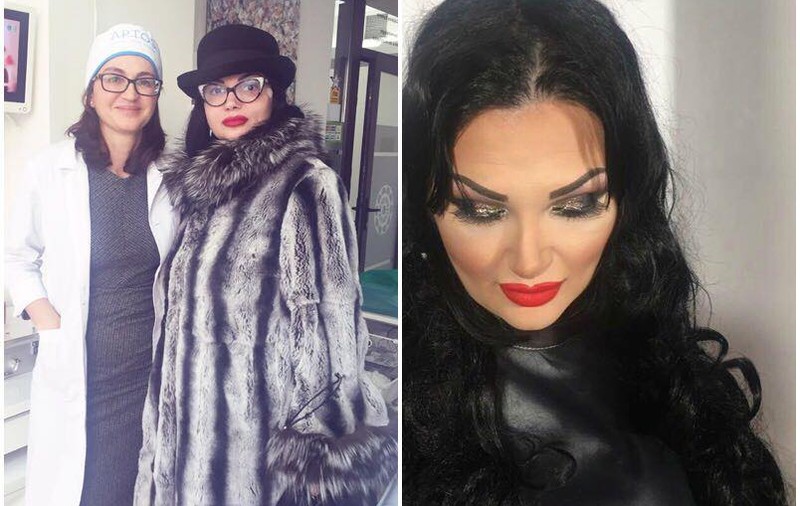 Ozana Barabancea, sfătuită să facă lifting facial după ce a slăbit 40 de kilograme. Cum arată acum