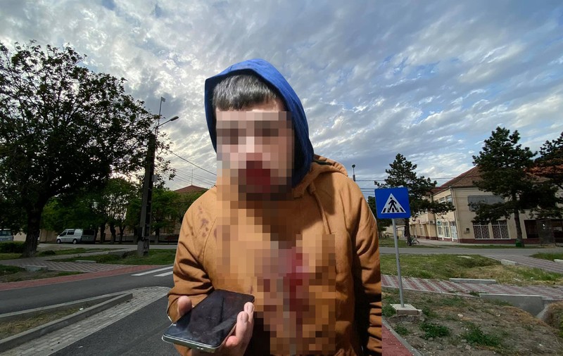 Tânăr desfigurat de adolescenții arestați pentru uciderea lui Mario Berinde. Victima și-a retras plângerea cu cinci zile înainte ca agresorii să comită crima de la Cenei: „L-a chemat la post unul dintre părinții criminalilor”