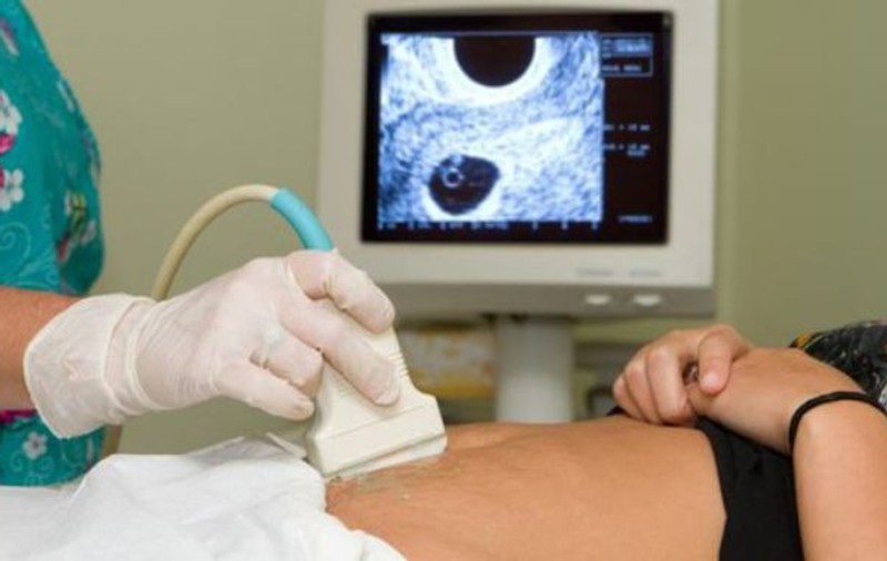 Şocul unei femei însărcinate, când s-a uitat pe prima ecografie. Ce a observat