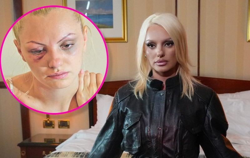 Alexandra Stan, declarații cutremurătoare la 12 ani după ce a fost bătută de fostul manager: „Aveam un profil de victimă, victima caută agresor”