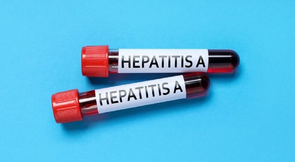 Focar de hepatita A la Brasov