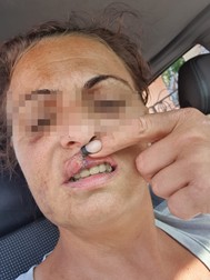 Maria* după agresiune