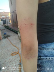 Rănile imediat după agresiune